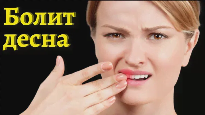 №1 У вас стоят коронки и началось воспаление десен