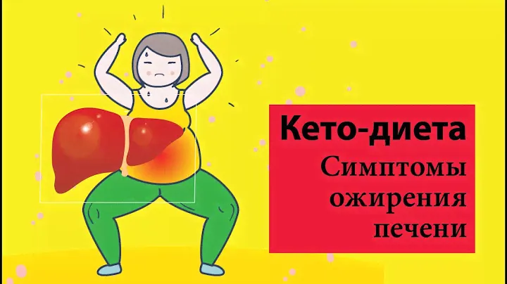 Симптомы ожирения печение | Жировой гепатоз